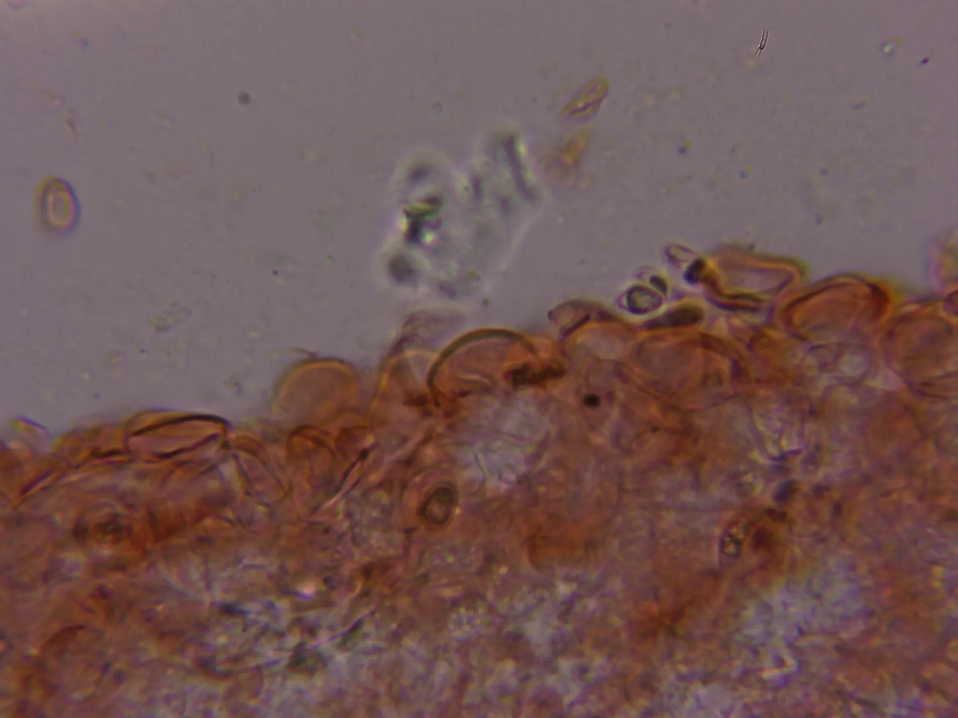 Microscopía de Marasmius wynneae - 12 - Suprapellis